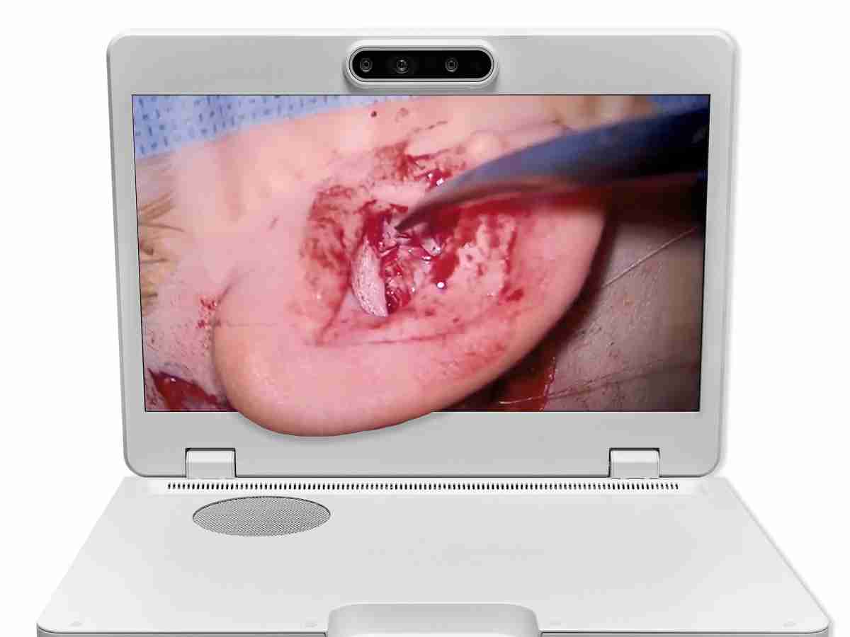 达擎之＂Heads-up 3D显微手术显示系统＂，，整合4K裸眼3D显示及眼球追踪系统，，，，具备快速追踪人眼移动位置功能，，，，减轻医师长时间维持固定姿势的负担，，，，让医师能有更宽广清晰的3D立体视野及更舒适的姿势来执行手术。。。